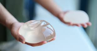 Breast Implant: जानें ब्रेस्ट इंप्लांटेशन प्रोसेस, खर्च और जोखिम – क्या आप इसके लिए तैयार हैं?