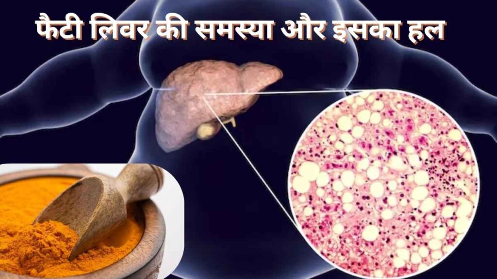 फैटी लिवर की समस्या और इसका हल, हल्दी से पाएं राहत, जानें कैसे