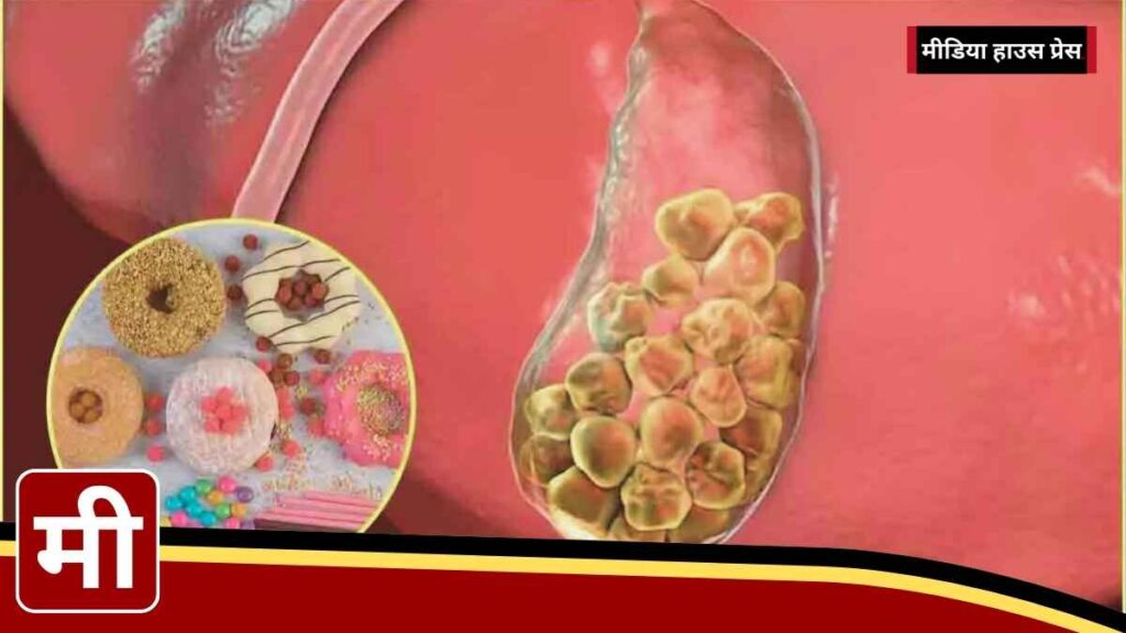 पित्ताशय में पथरी से बचने के लिए इन 5 चीज़ों से बनाएं दूरी, जानें Gallbladder Stones के कारण और संकेत